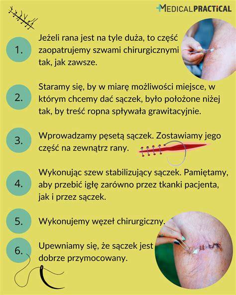 Schematyczny proces przygotowania sztucznej rany z użyciem żelatyny